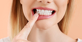Tipps für gesundes Zahnfleisch